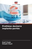 Prothèse dentaire implanto-portée di Kapil Singla, Deepak Goyal edito da Editions Notre Savoir