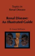 Renal Disease: An Illustrated Guide di D. G. Williams edito da Springer Netherlands