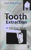 Tooth Extraction di Paul D. Robinson edito da Elsevier Health Sciences