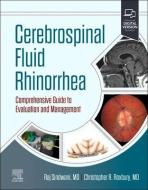 Cerebrospinal Fluid Rhinorrhea: Comprehensive Guide to Evaluation and Management edito da ELSEVIER