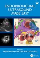 Endobronchial Ultrasound Bronchoscopy: Made Easy edito da Taylor & Francis Ltd