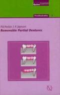 Removable Partial Dentures di Nicholas Jepson edito da Quintessence Publishing (IL)