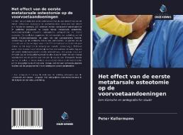 Het effect van de eerste metatarsale osteotomie op de voorvoetaandoeningen di Peter Kellermann edito da Uitgeverij Onze Kennis