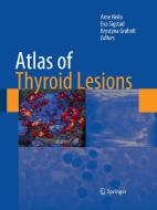 Atlas of Thyroid Lesions edito da Springer New York