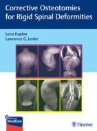 Rigid Spine Deformities edito da Georg Thieme Verlag