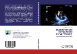 Ishemicheskaq mitral'naq regurgitaciq di Vladimir Zhelnow edito da LAP LAMBERT Academic Publishing