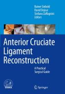 Anterior Cruciate Ligament Reconstruction edito da Springer-verlag Berlin And Heidelberg Gmbh & Co. Kg
