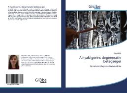 A nyaki gerinc degeneratív betegségei di Rigó Kitti edito da GlobeEdit