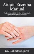 Atopic Eczema Manual di John Dr. Robertson John edito da Independently Published