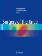 Surgery of the Knee edito da Springer London Ltd