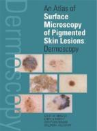 An Atlas Of Surface Microscopy Of Pigmented Skin Lesions di Scott W. Menzies, Kerry A. Crotty, Christian Ingwar, William H. McCarthy edito da Mcgraw-hill Education - Europe