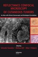Reflectance Confocal Microscopy Of Cutaneous Tumors edito da Taylor & Francis Ltd