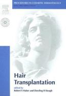 Hair Transplantation di Robert S. Haber, Dow B. Stough edito da Elsevier - Health Sciences Division