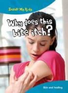 Why Does This Bite Itch? di Steve Parker edito da Capstone Global Library Ltd