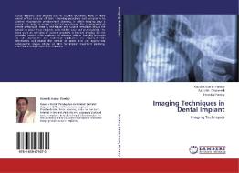 Imaging Techniques in Dental Implant di Kaushik Kumar Pandey, Saurabh Chaturvedi, Preetika Pandey edito da LAP Lambert Academic Publishing
