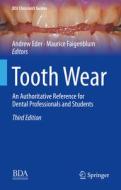 Tooth Wear edito da Springer International Publishing