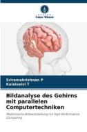 Bildanalyse des Gehirns mit parallelen Computertechniken di Sriramakrishnan P, Kalaiselvi T edito da Verlag Unser Wissen