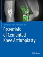 Essentials of Cemented Knee Arthroplasty edito da Springer Berlin Heidelberg