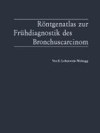 Röntgenatlas zur Frühdiagnostik des Bronchuscarcinom di Elvira Lobenwein-Weinegg edito da Springer Berlin Heidelberg