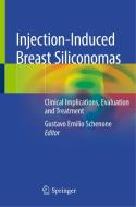Injection-Induced Breast Siliconomas edito da Springer International Publishing