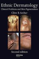 Ethnic Dermatology di Clive B. Archer edito da Taylor & Francis Ltd