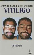 How to Cure a Skin Disease: Vitiligo di J. S. Pasricha edito da Jaypee Brothers Medical Publishers