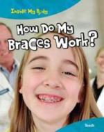 How Do My Braces Work? di Steve Parker edito da Capstone Global Library Ltd