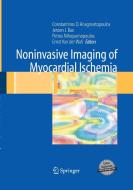 Noninvasive Imaging of Myocardial Ischemia edito da Springer London