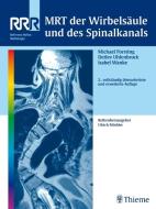 MRT der Wirbelsäule und des Spinalkanals edito da Thieme Georg Verlag