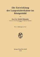 Die Entwicklung der Lungentuberkulose im Röntgenbild di Erich Zdansky edito da Springer Vienna