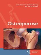 Osteoporose di Harald Dobnig, Karin Gruber edito da Verlagshaus der Ärzte