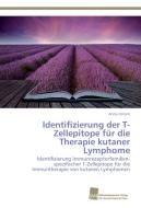Identifizierung der T-Zellepitope für die Therapie kutaner Lymphome di Anna Ostant edito da Südwestdeutscher Verlag für Hochschulschriften AG  Co. KG