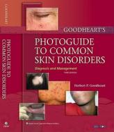 Goodheart's Photoguide To Common Skin Disorders di Herbert P. Goodheart edito da Lippincott Williams And Wilkins
