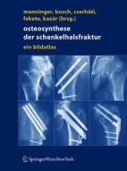 Osteosynthese der Schenkelhalsfraktur edito da Springer Vienna