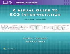A Visual Guide to ECG Interpretation di Martindale edito da Lippincott Williams and Wilkins