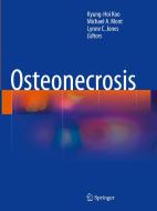 Osteonecrosis edito da Springer-verlag Berlin And Heidelberg Gmbh & Co. Kg