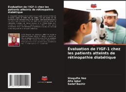 Évaluation de l'IGF-1 chez les patients atteints de rétinopathie diabétique di Shagufta Naz, Afia Iqbal, Sadaf Bashir edito da Editions Notre Savoir