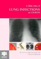 Atlas Of Lung Infections di #Costello,  J.f. Saunders,  Dawn E. Philpott-howard,  John edito da Taylor & Francis Ltd