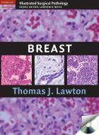 Breast di Thomas J. Lawton edito da Cambridge University Press