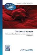 Testicular cancer edito da FastBook Publishing