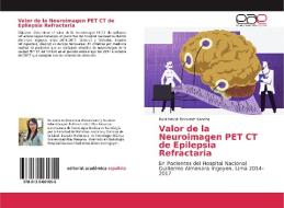 Valor de la Neuroimagen PET CT de Epilepsia Refractaria di Rubi Melodi Documet Kancha edito da EAE