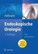 Endoskopische Urologie: Atlas Und Lehrbuch edito da Springer