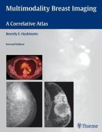 Multimodality Breast Imaging di Beverly Hashimoto, Donald Bauermeister edito da Thieme Georg Verlag