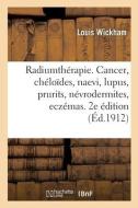 Radiumtherapie. Cancer, Cheloides, Naevi, Lupus, Prurits, Nevrodermites, Eczemas di WICKHAM-L edito da Hachette Livre - BNF