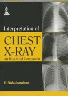 Interpretation Of Chest X-ray di G. Balachandran edito da Jaypee Brothers Medical Publishers