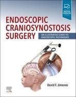 Endoscopic Craniosynostosis Surgery: An Illustrated Guide to Endoscopic Techniques edito da ELSEVIER