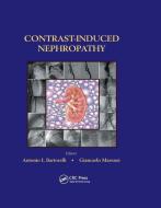 Contrast-Induced Nephropathy in Interventional Cardiovascular Medicine edito da Taylor & Francis Ltd