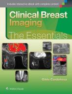Clinical Breast Imaging: The Essentials di Gilda Cardenosa edito da Lippincott Williams&Wilki