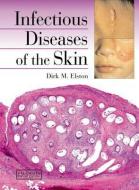 Infectious Diseases of the Skin di Dirk M. Elston edito da CRC Press