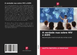 A verdade nua sobre HIV e AIDS di Aletta Matopollo Monyake edito da Edições Nosso Conhecimento